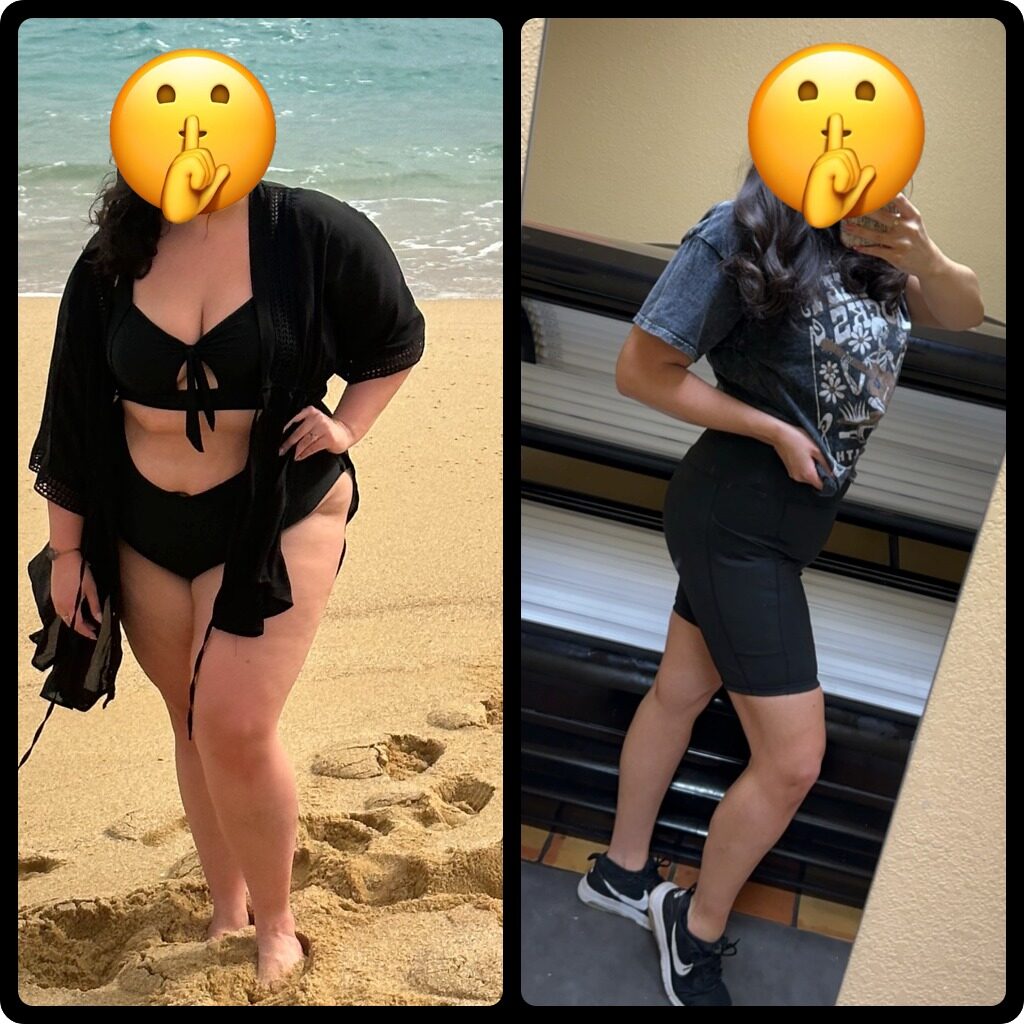 Patient progress photos during a medically supervised weight loss program